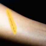 arm-wound-knife-260nw-579569335